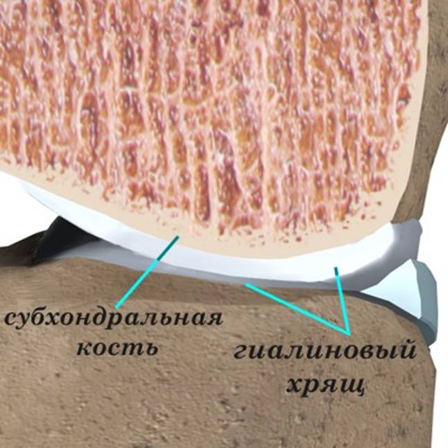 http://www.orthospine.ru/orthopedics/methods/img/artrit.jpg