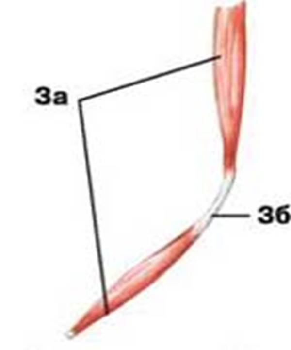 m2